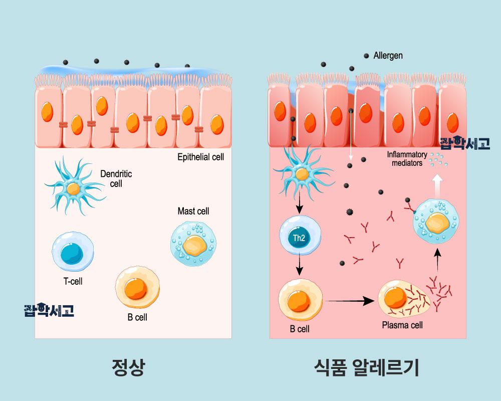 How Food Allergies Develop