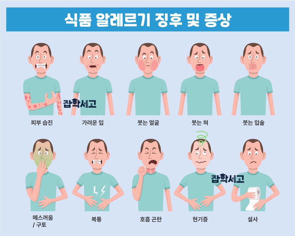 Various Symptoms of Food Allergies